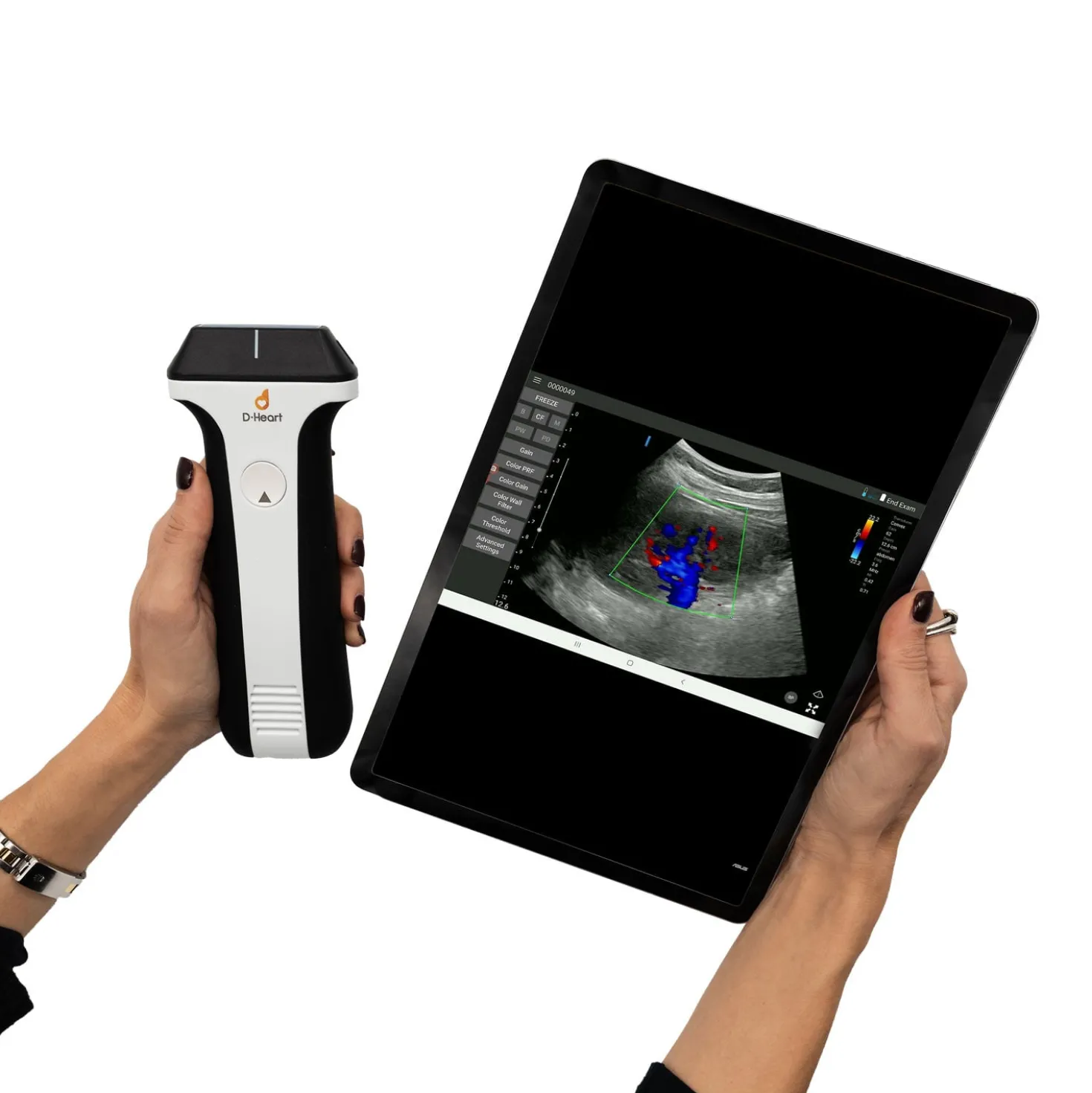 D-Heart handheld Ultraschallgerät