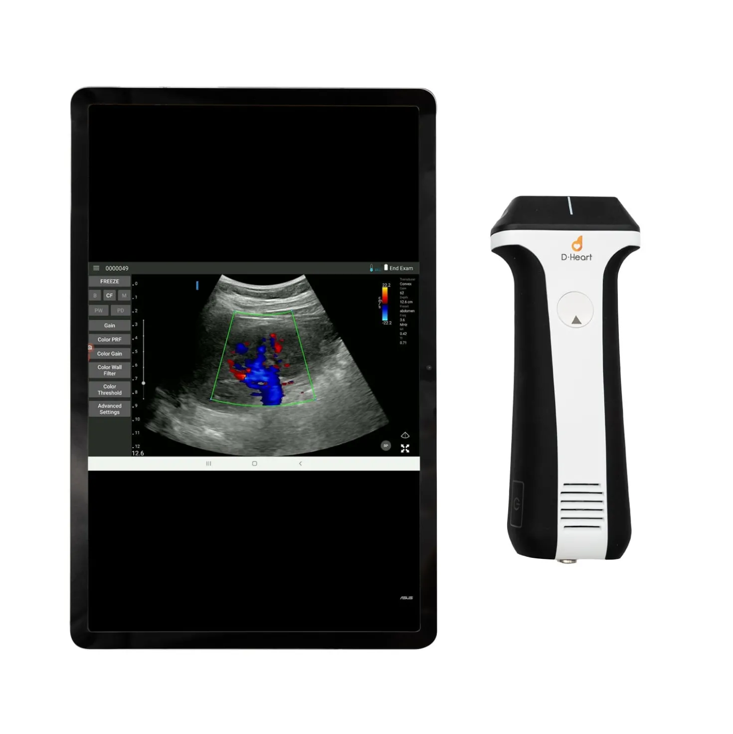 D-Heart handheld Ultraschallgerät