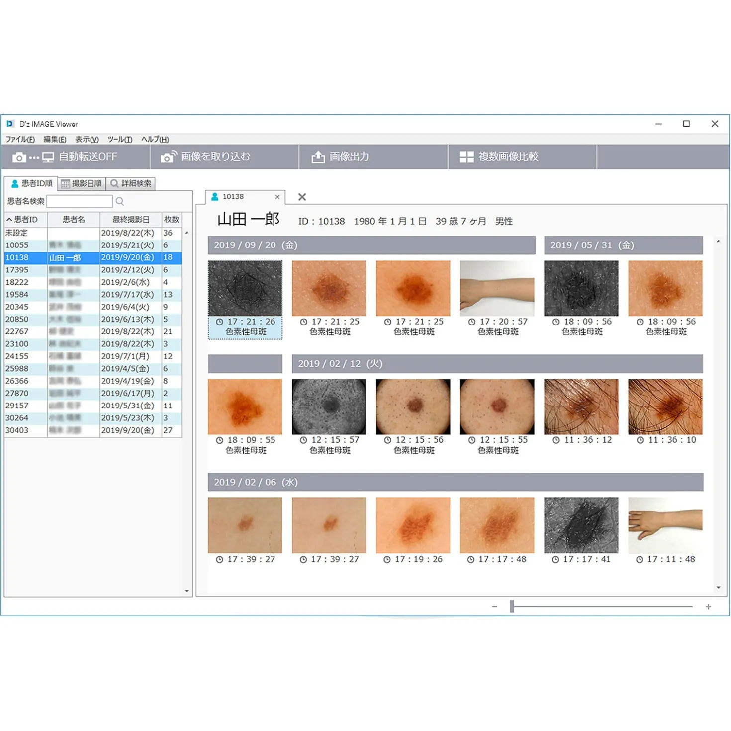 DZ-D100 Dermatologie-Kamera