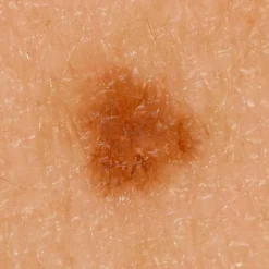 DZ-D100 Dermatologie-Kamera
