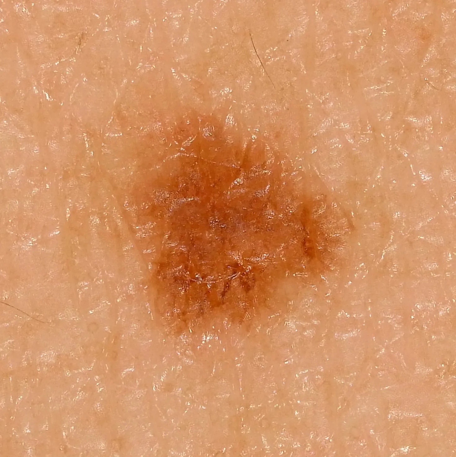 DZ-D100 Dermatologie-Kamera