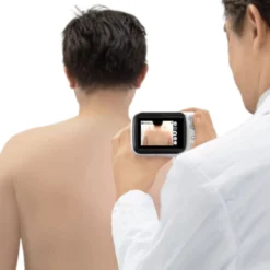DZ-D100 Dermatologie-Kamera