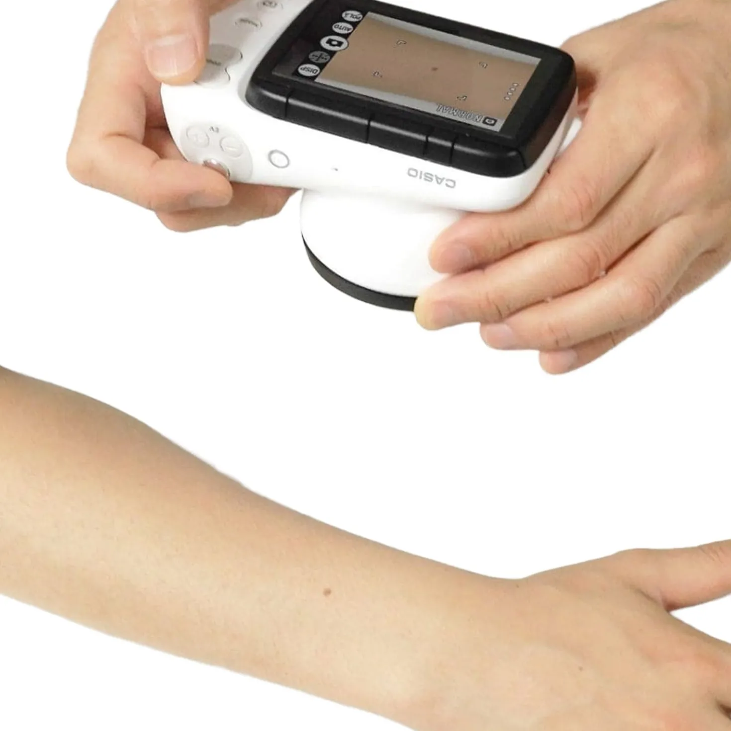 DZ-D100 Dermatologie-Kamera