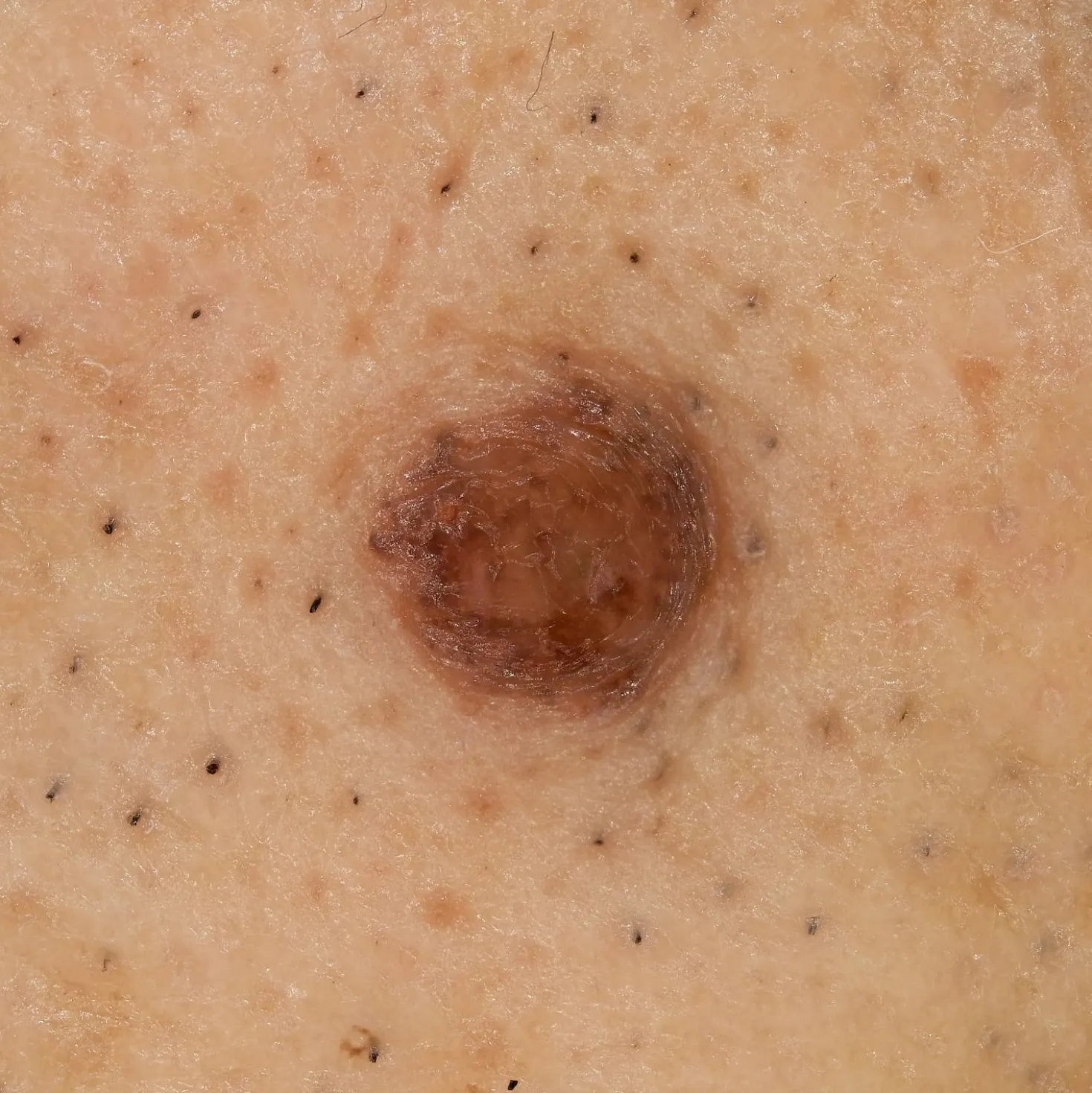 DZ-D100 Dermatologie-Kamera