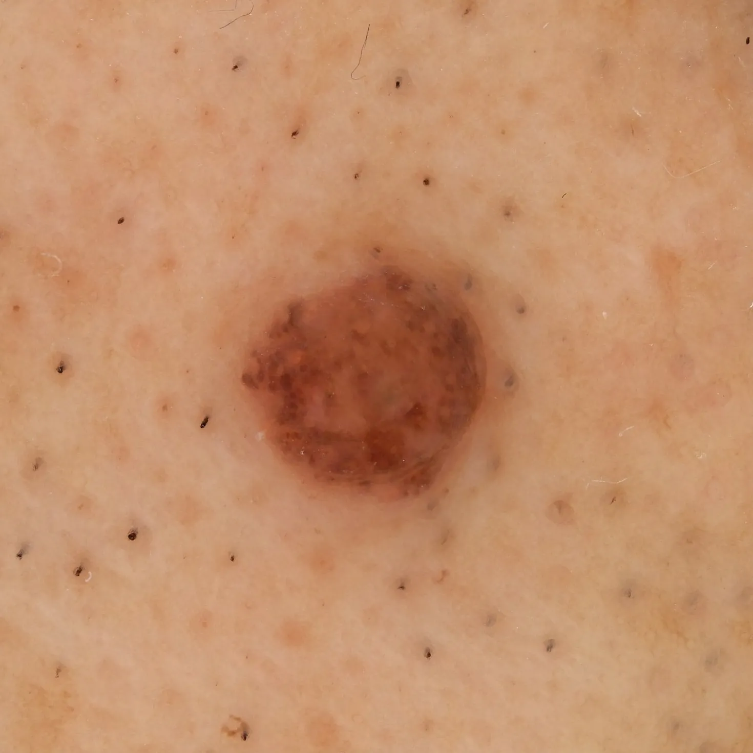 DZ-D100 Dermatologie-Kamera