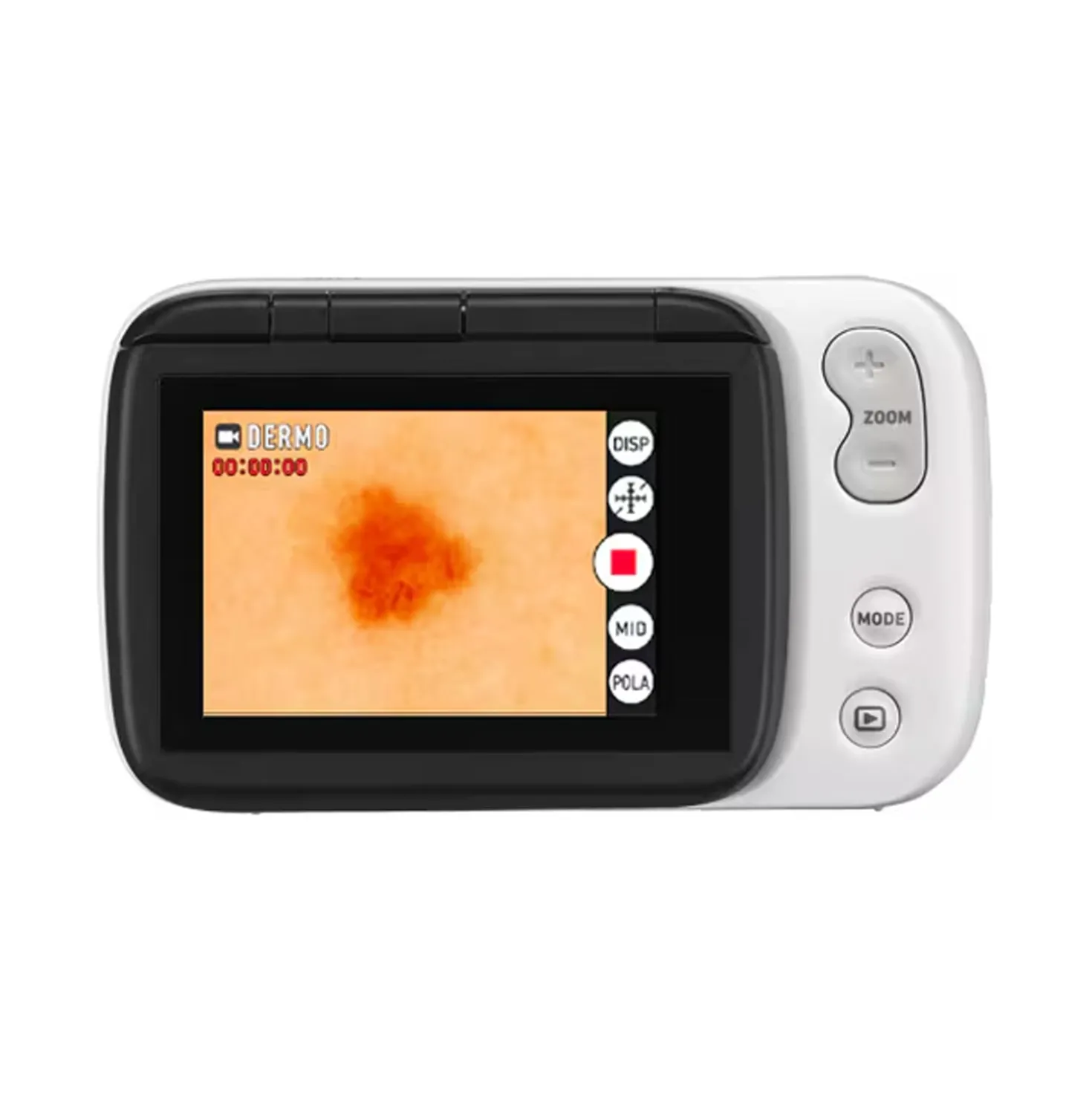 DZ-D100 Dermatologie-Kamera