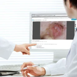 DZ-D100 Dermatologie-Kamera
