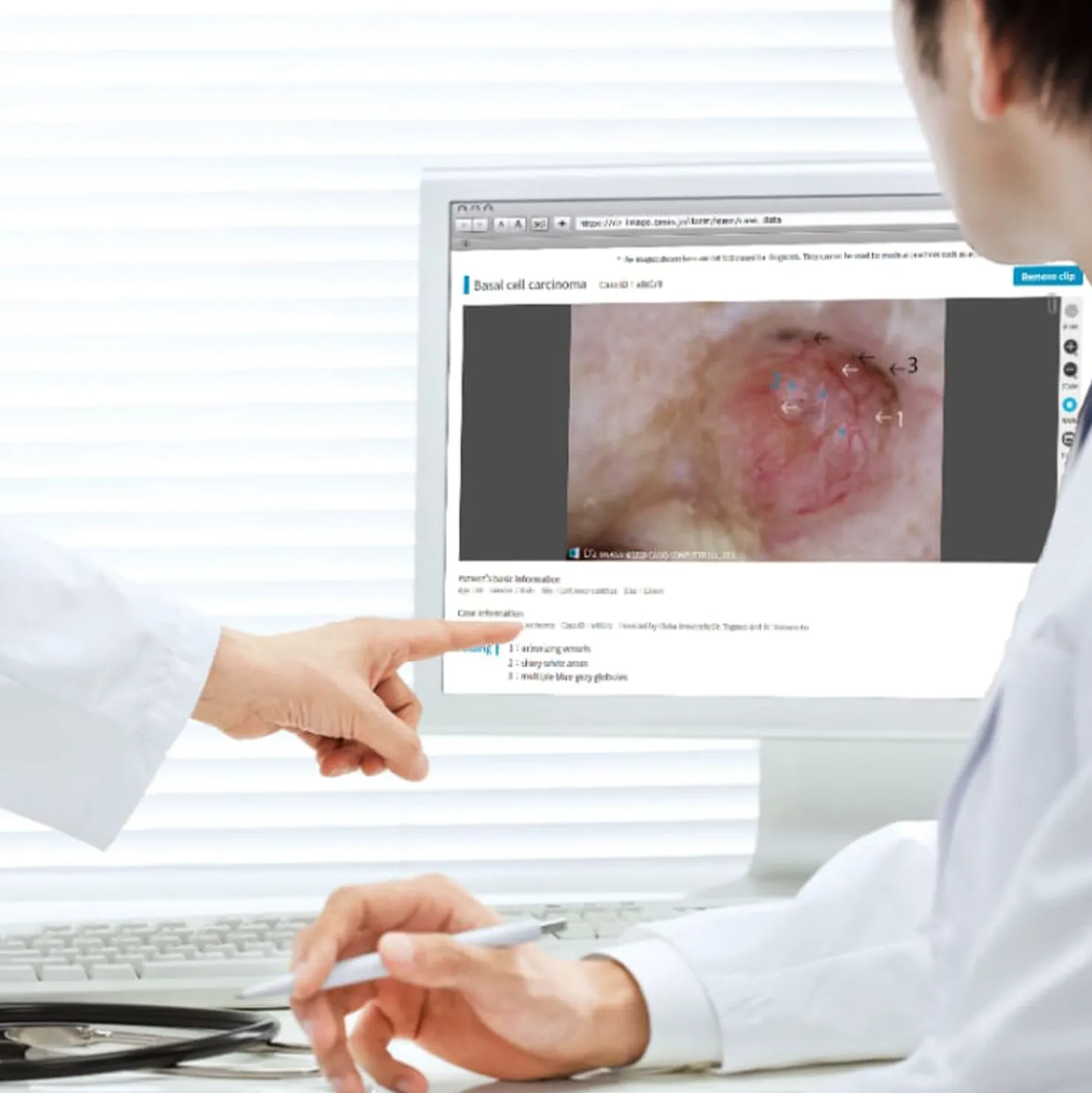 DZ-D100 Dermatologie-Kamera