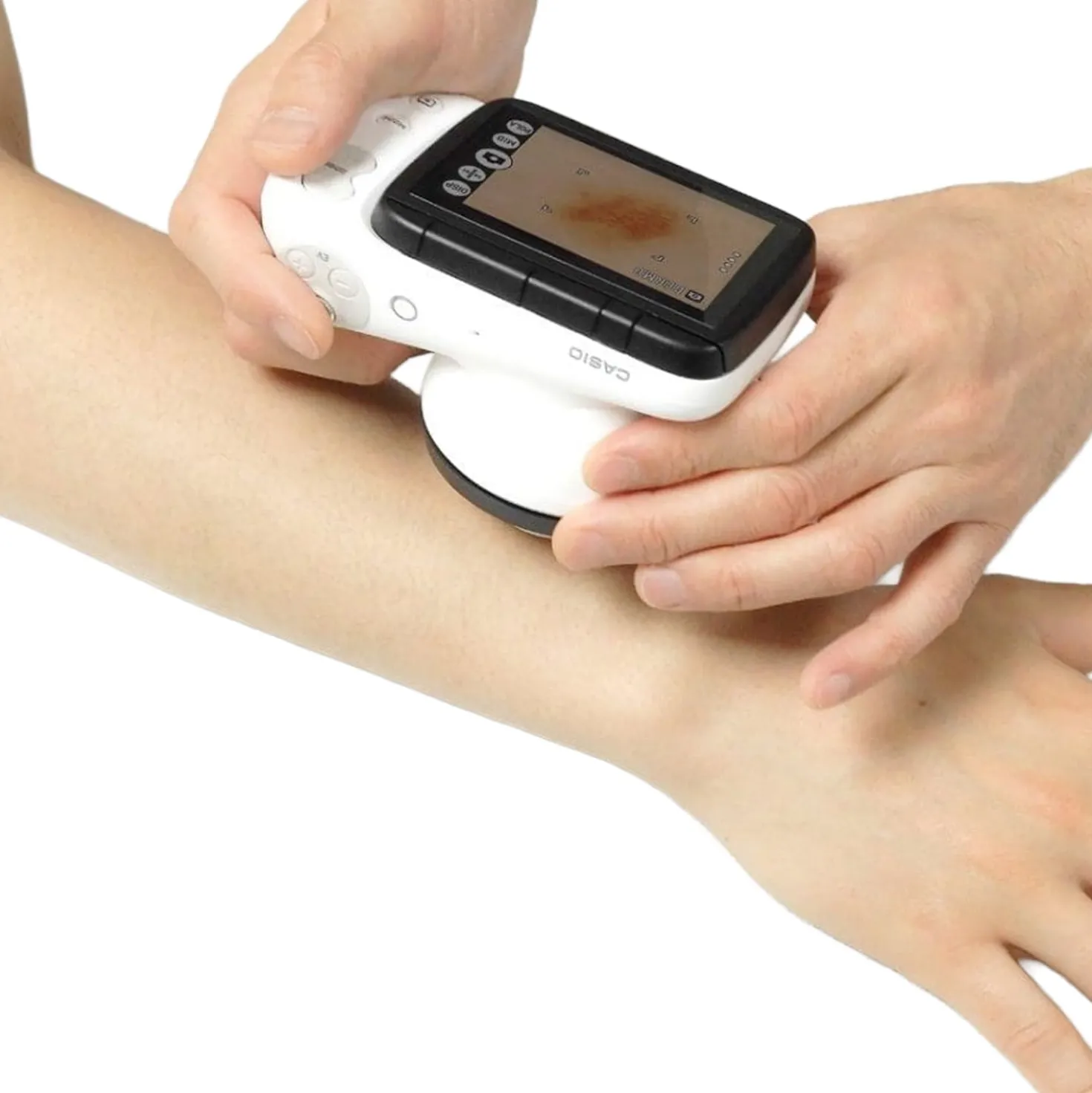 DZ-D100 Dermatologie-Kamera