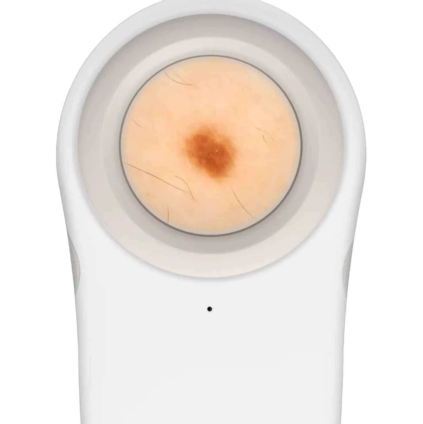 DZ-S50 Dermatoskop