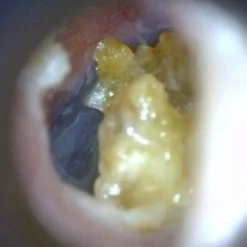 EarScope Basic (kabellos)