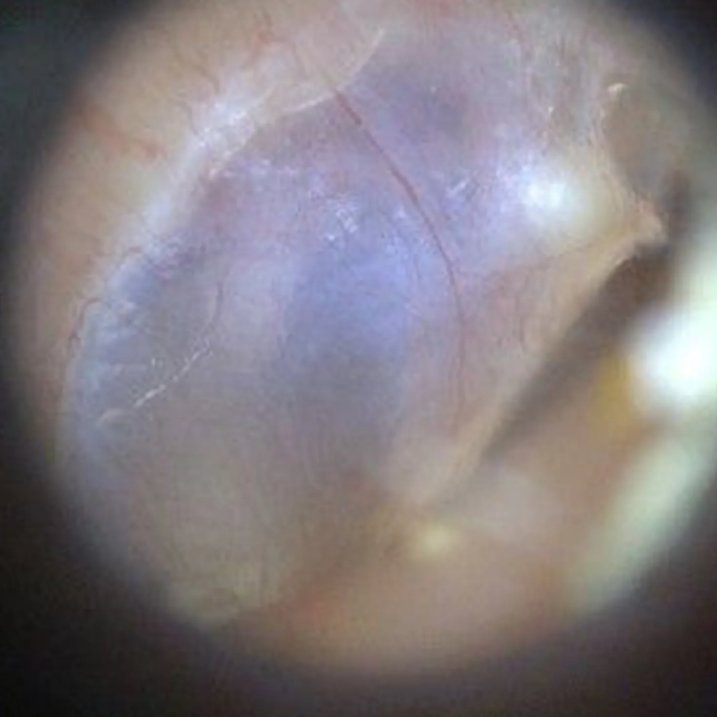 EarScope Basic (kabellos)