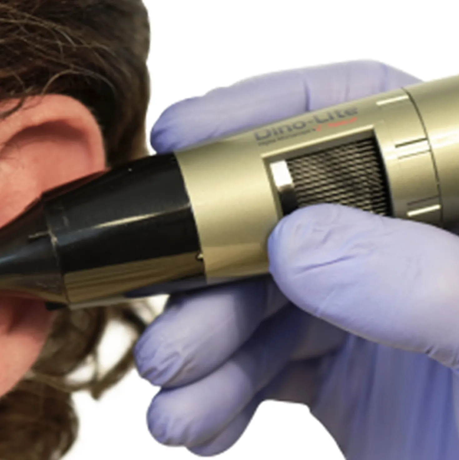 EarScope Pro