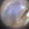 EarScope Pro (kabellos)