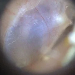 EarScope Pro (kabellos)