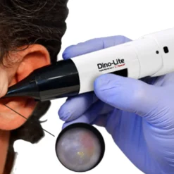 EarScope Pro (kabellos)