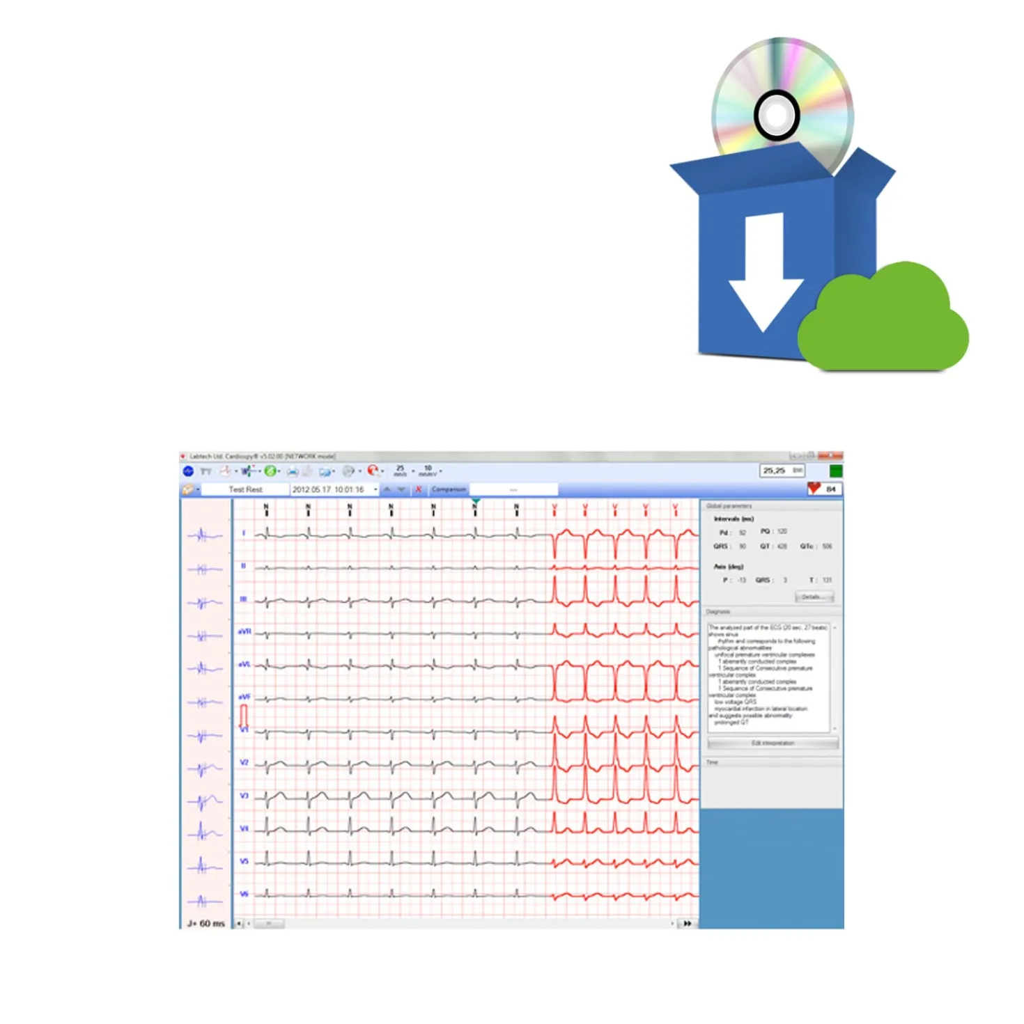 ECG-1000 EKG-Management Software für Biocare