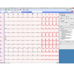 EC-12R PC-Ruhe-EKG