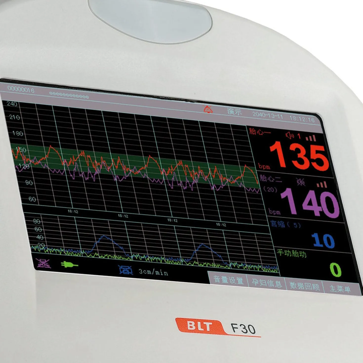 Fetalmonitor F30