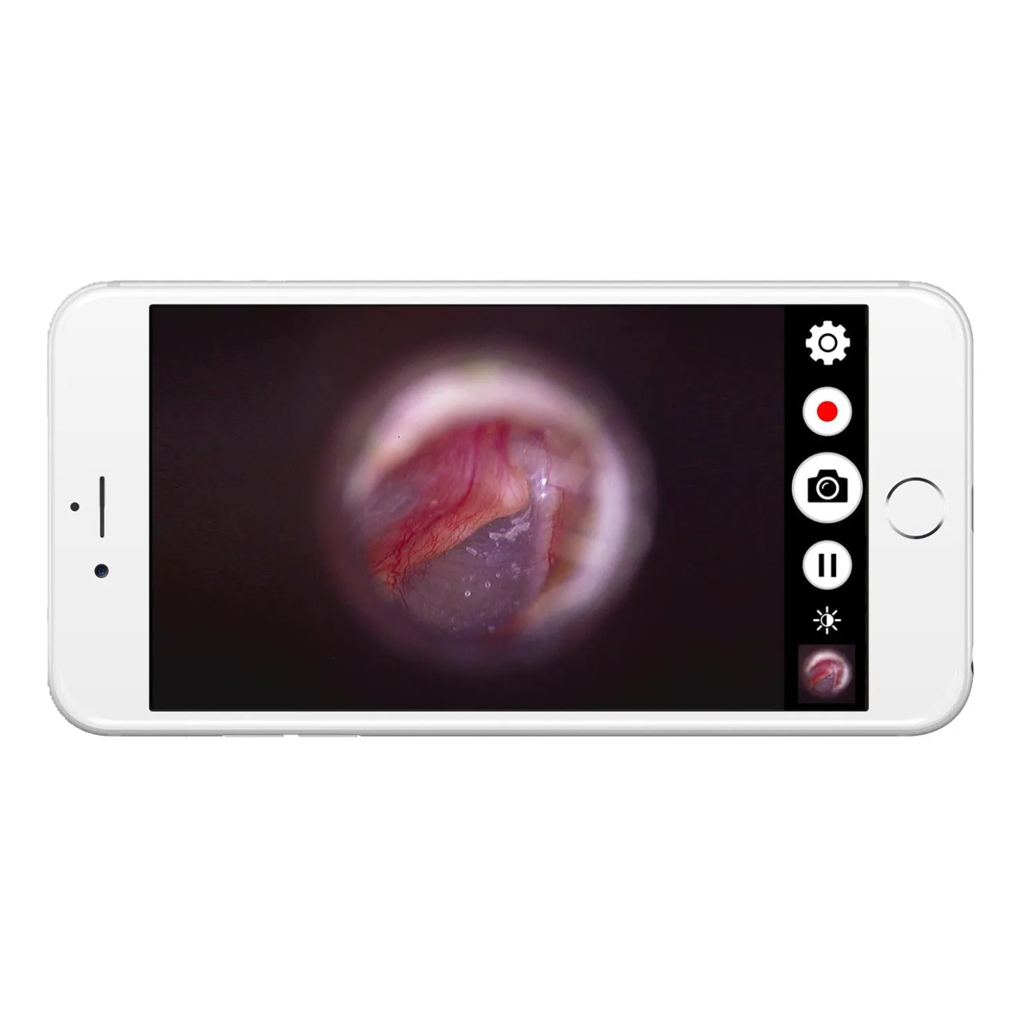 Firefly DE 1270 digitale HD-Endoskopkamera