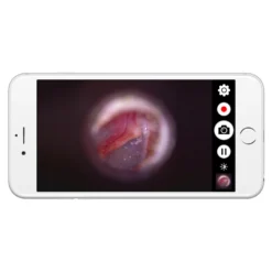 Firefly DE570 W-LAN HD Digital-Otoskop