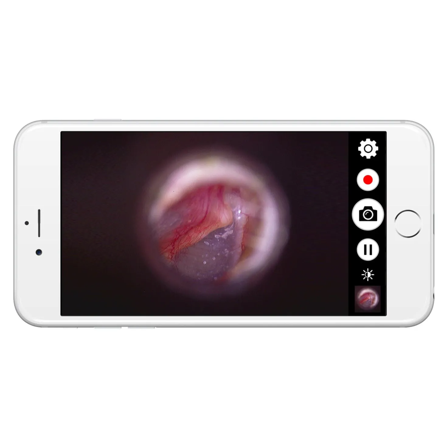 Firefly DE570 W-LAN HD Digital-Otoskop