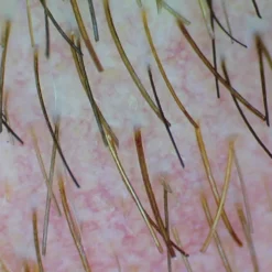 «Firefly» Videodermatoskop