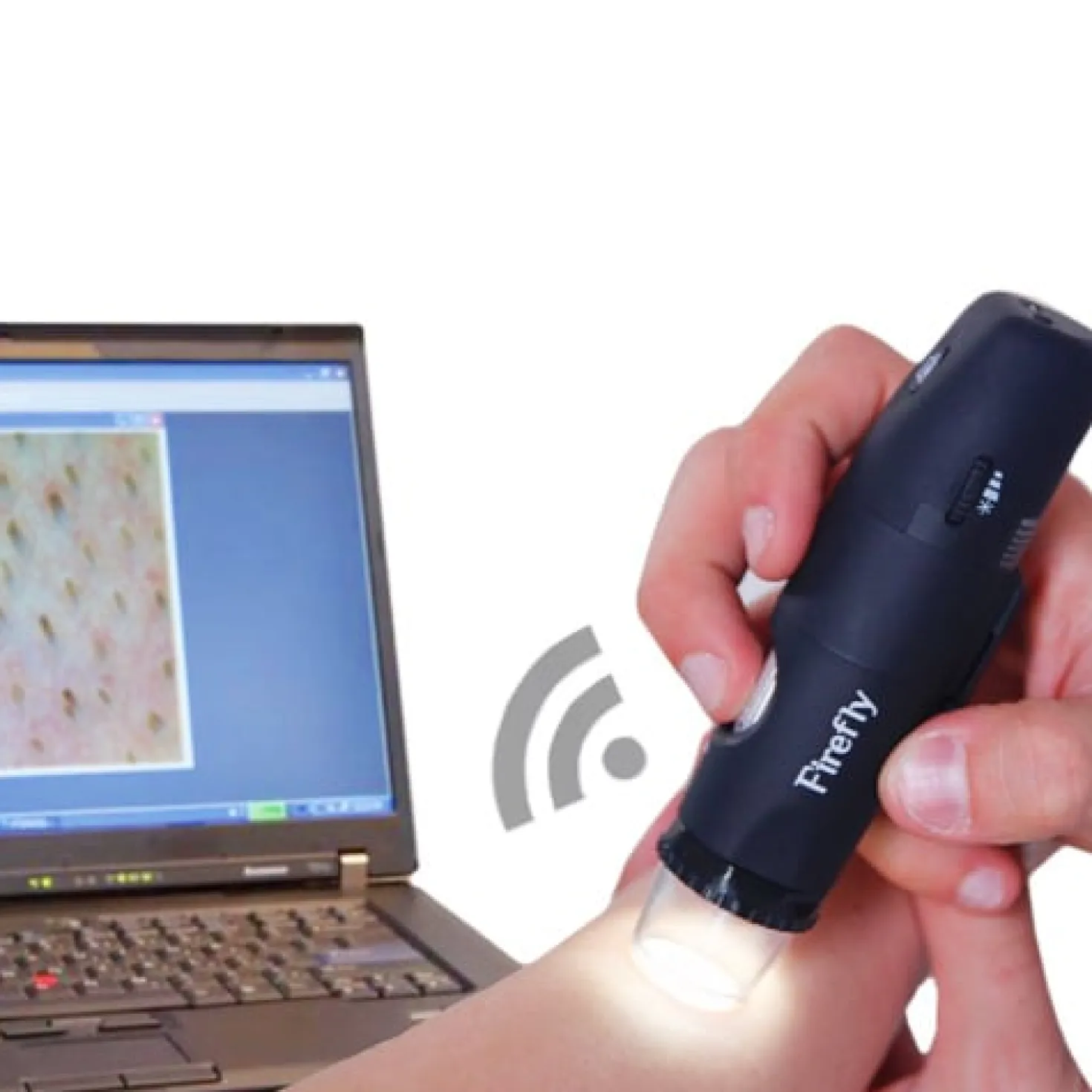 «Firefly» Videodermatoskop