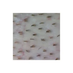 «Firefly» Videodermatoskop