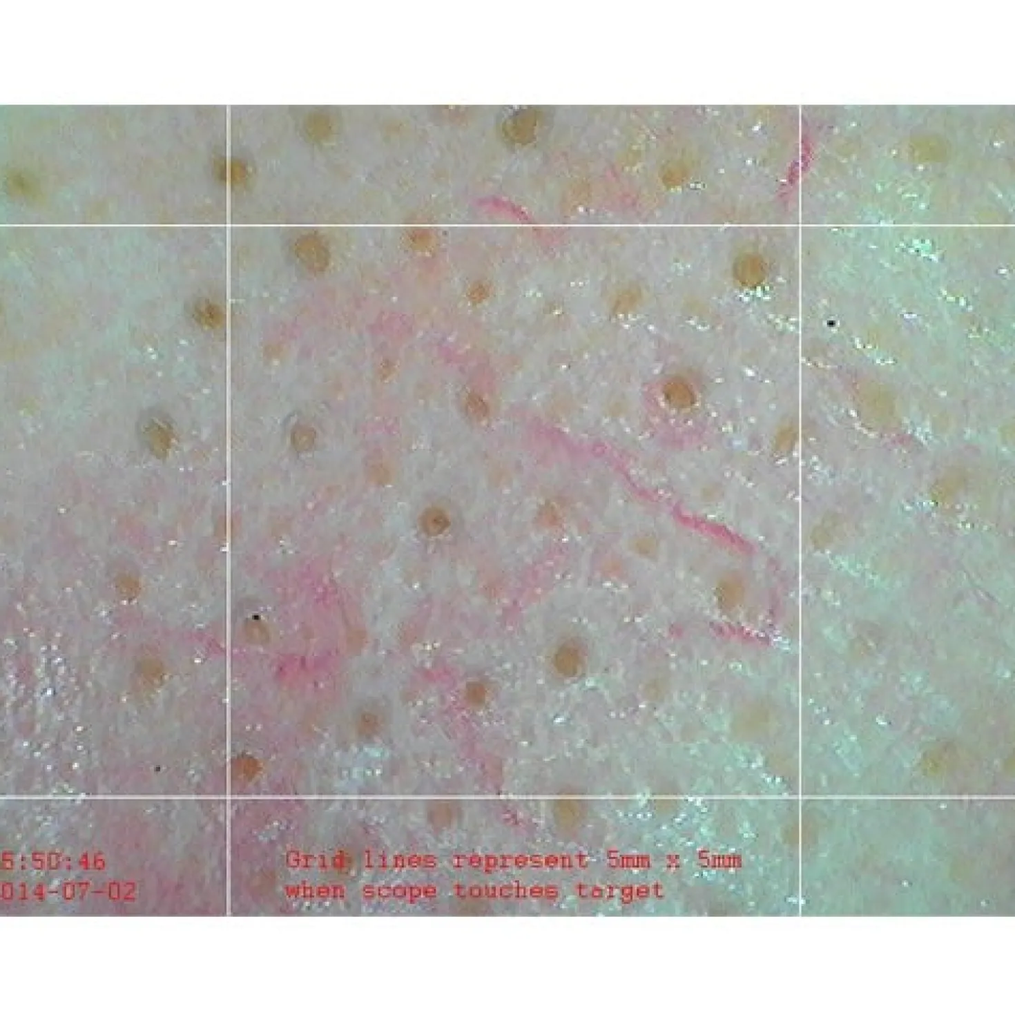 «Firefly» Videodermatoskop