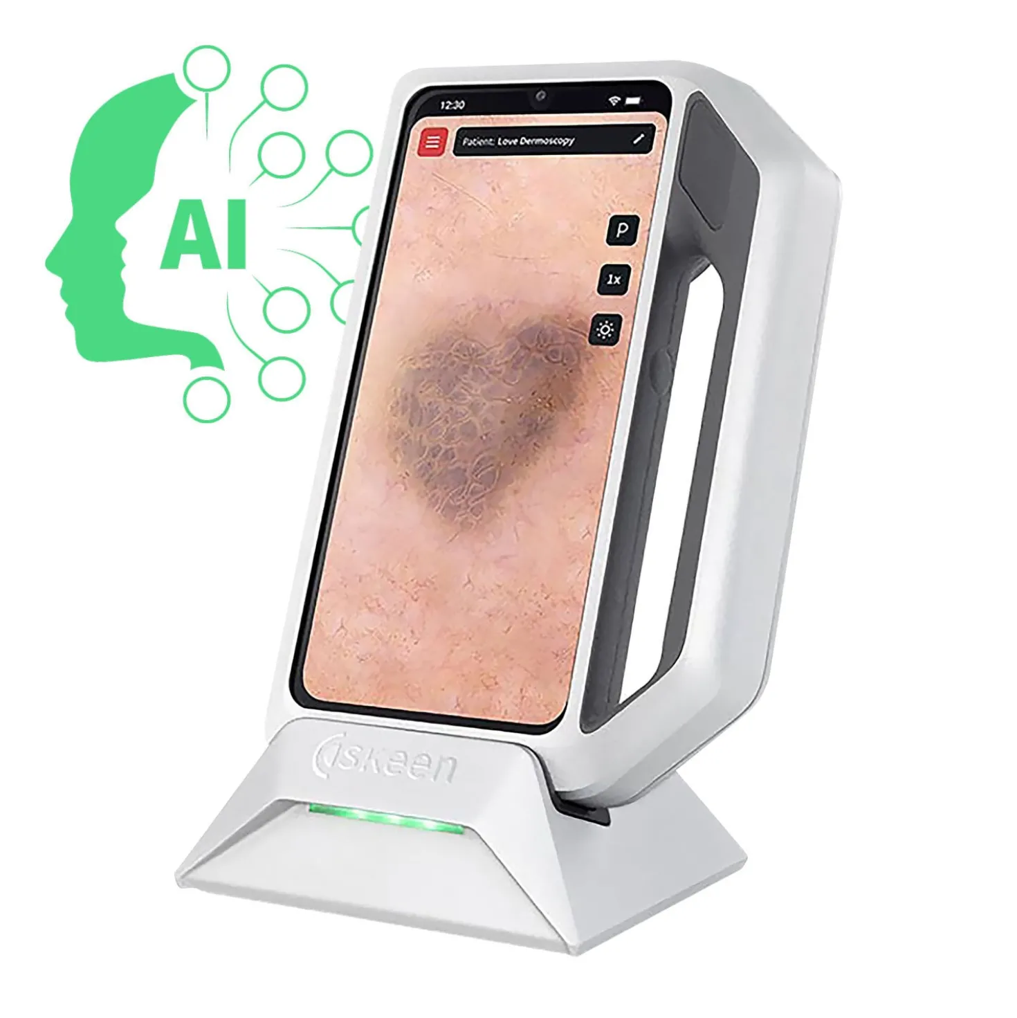 FotoFinder® Dermatoscopy Lizenz