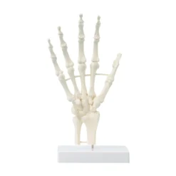 Handskelett mit Strukturen, unbeweglich