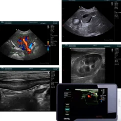 H1300 Ultraschallsystem