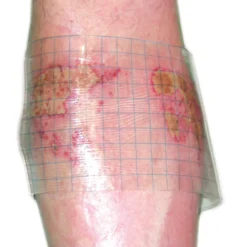 HydroTac transparent Gelverband