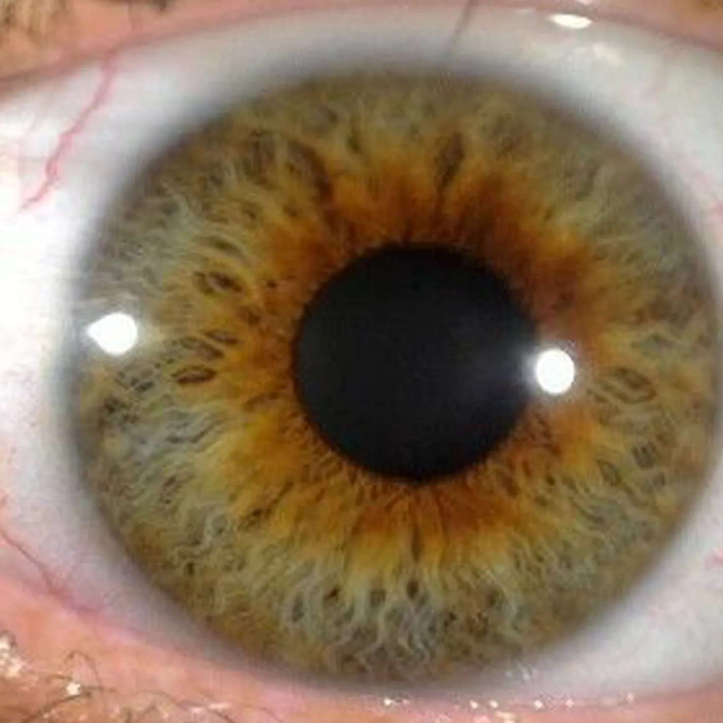 IriScope