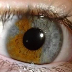 IriScope