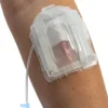 IV Glove Easystick