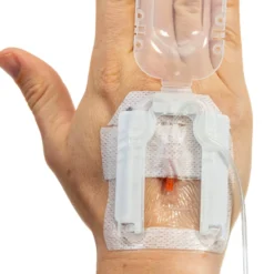 IV Glove Easystick