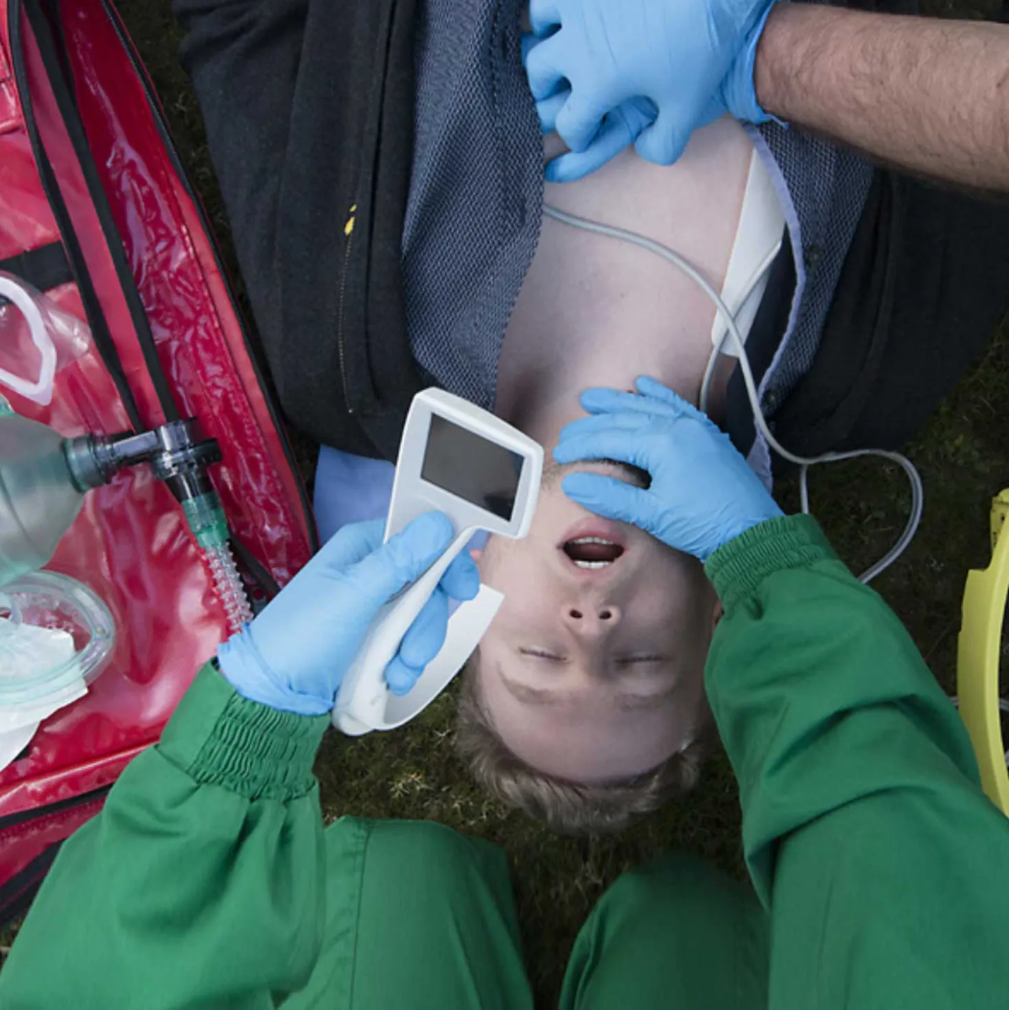 i-view Videolaryngoskop von Intersurgical
