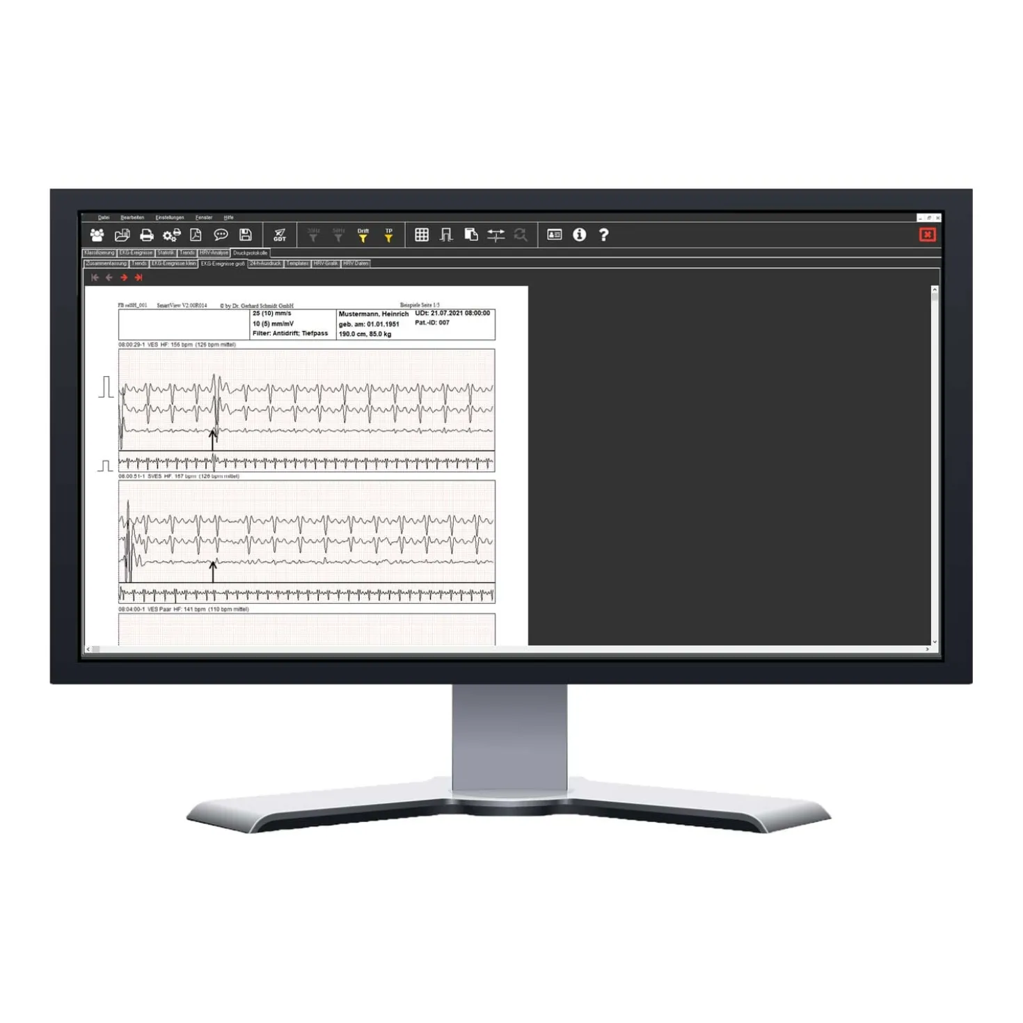 Langzeit-EKG Kobold II Auswertepaket