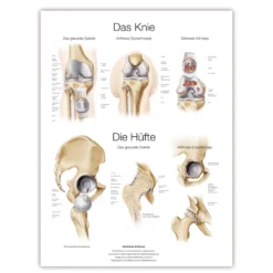 Lehrtafel Das Knie/ Die Hüfte