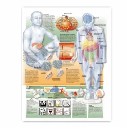 Lehrtafel Diabetes