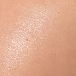 LuxaScope Dermatoskop mit Polarisationsfilter