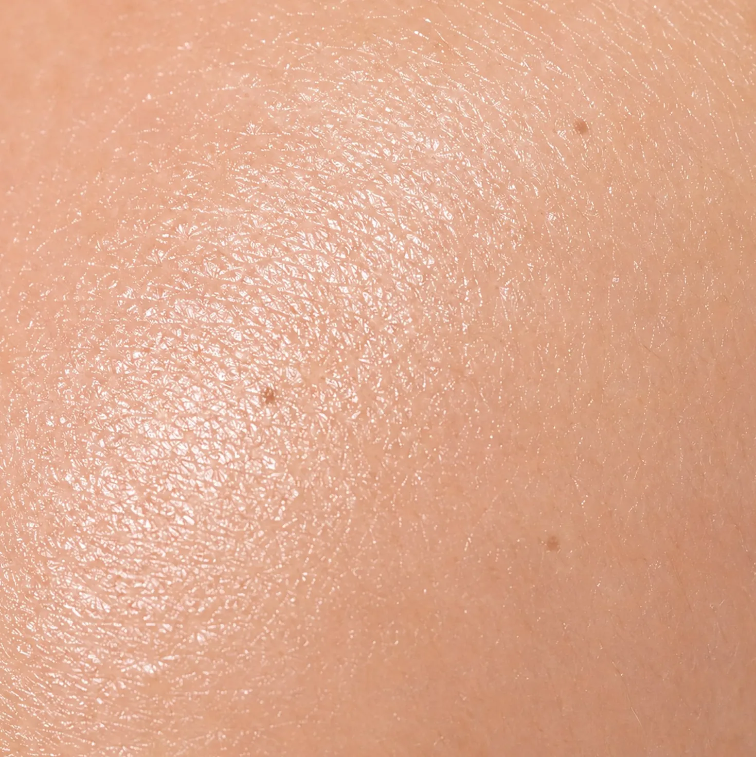 LuxaScope Dermatoskop mit Polarisationsfilter