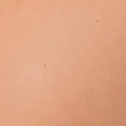 LuxaScope Dermatoskop mit Polarisationsfilter