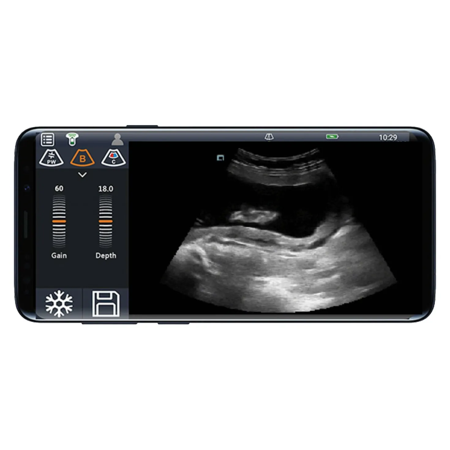 Mobiles Ultraschallsystem Youkey D8
