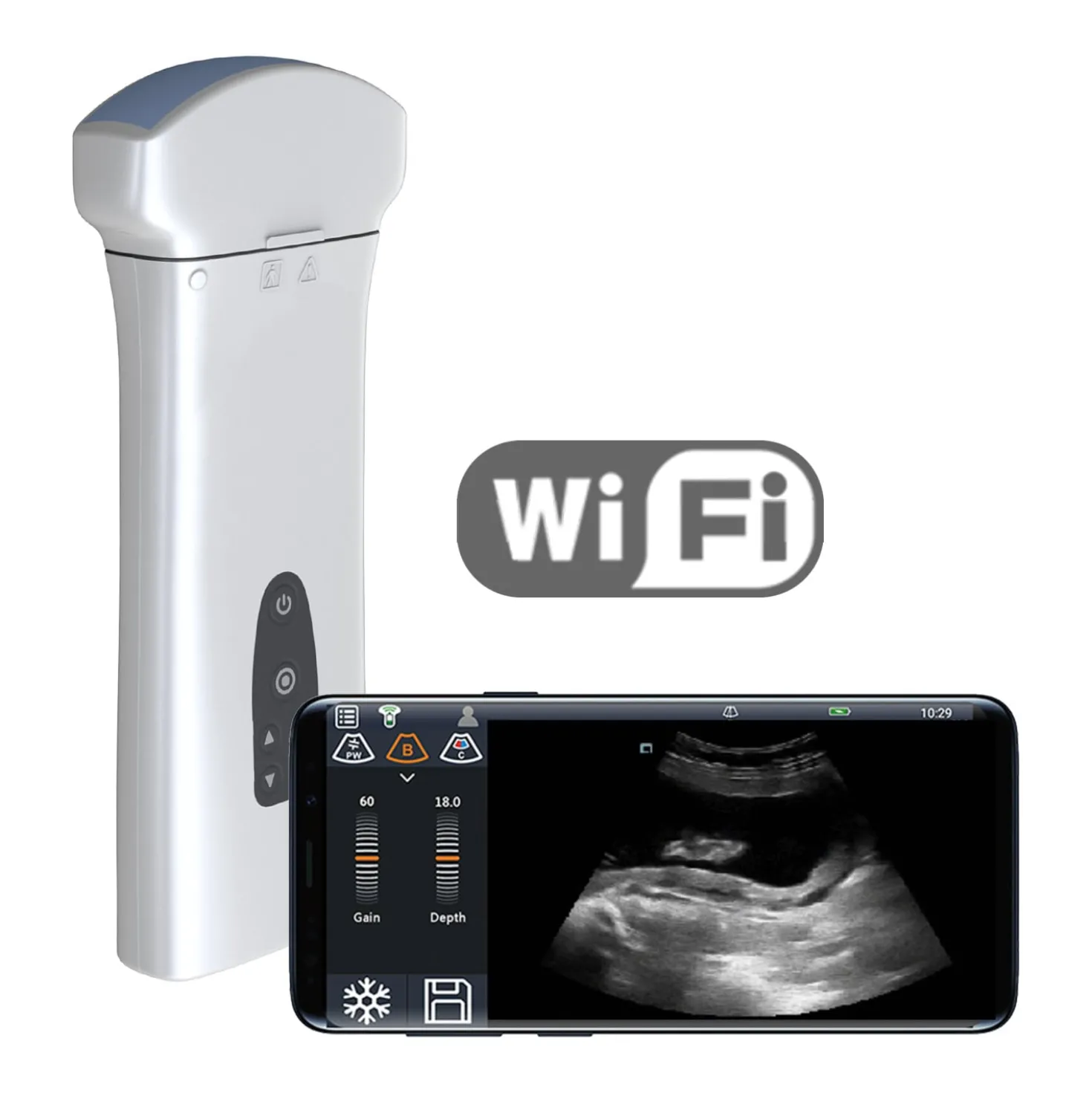 Mobiles Ultraschallsystem Youkey D8