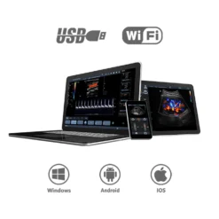 Mobiles Ultraschallsystem Youkey D8