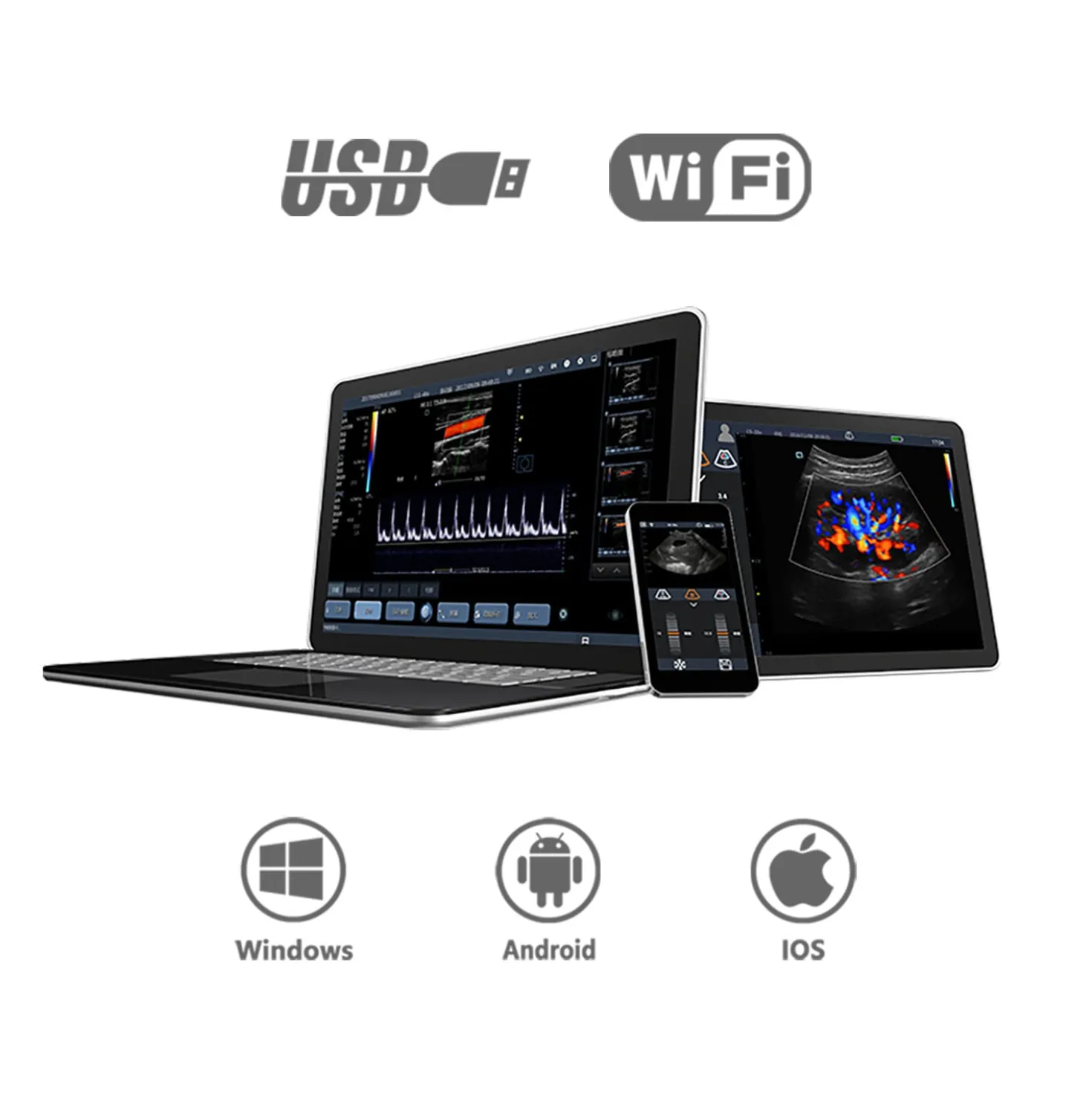 Mobiles Ultraschallsystem Youkey D8