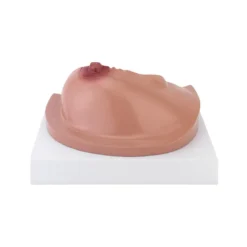 Modell der weiblichen Brust mit Erkrankungen